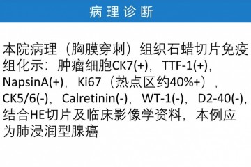 重疾险水太深 不了解的90%都买错了，买哪款好，这篇文告诉你